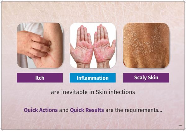 Fungal Infection - Image 2